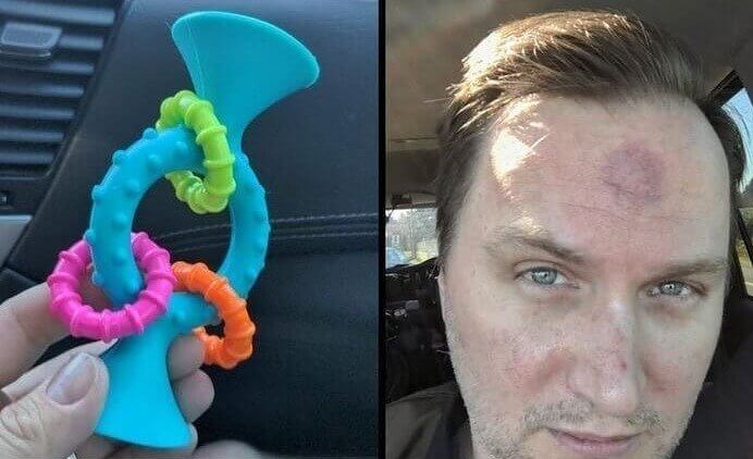 "Never Stick a Suction Toy to Your Head and Let Your Kid Pull on It"